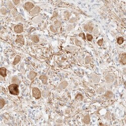 Syntrophin beta 1 Antibody, Novus Biologicals 25 &mu;L; Unlabeled:Antibodies,